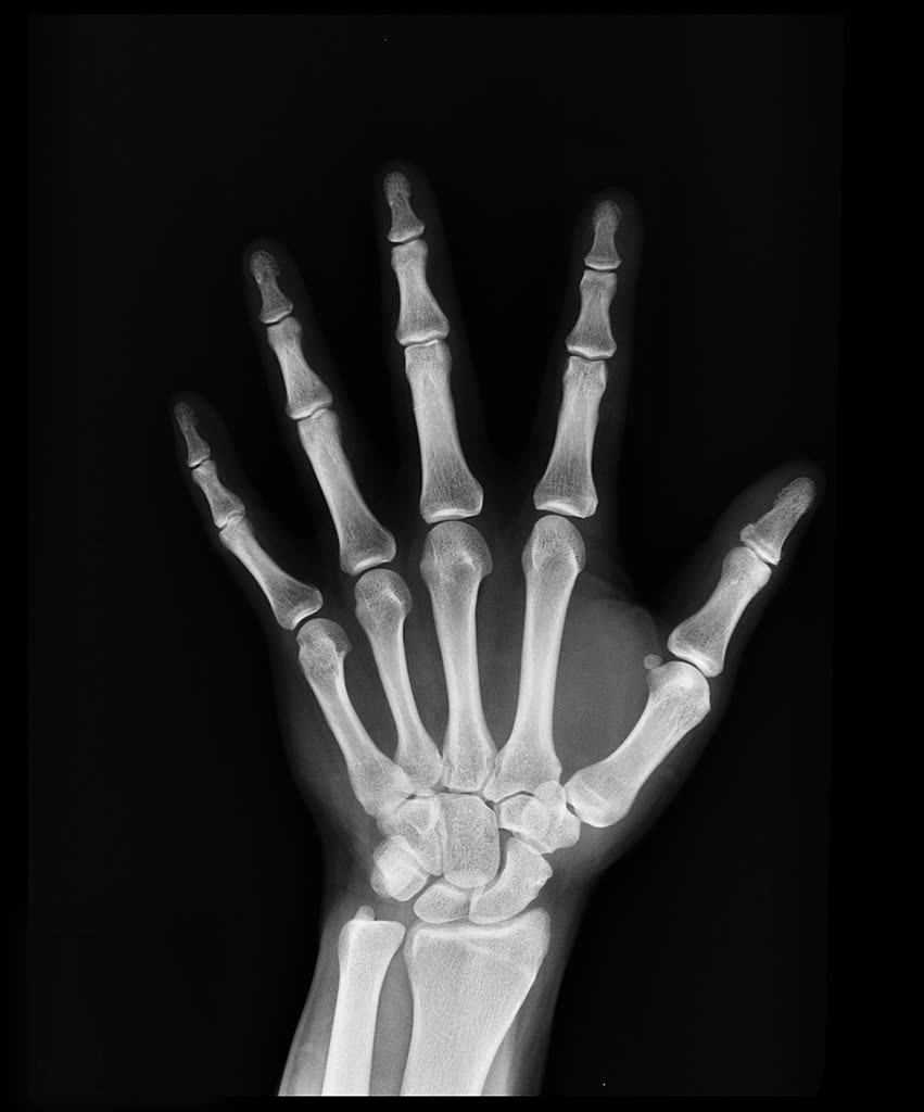 X-ray of a hand and wrist